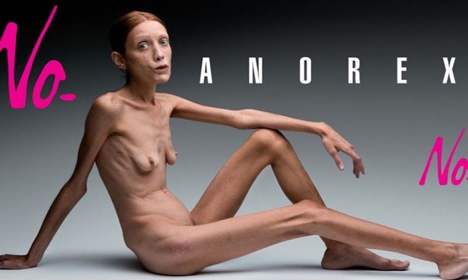 La Francia dice no all’anoressia